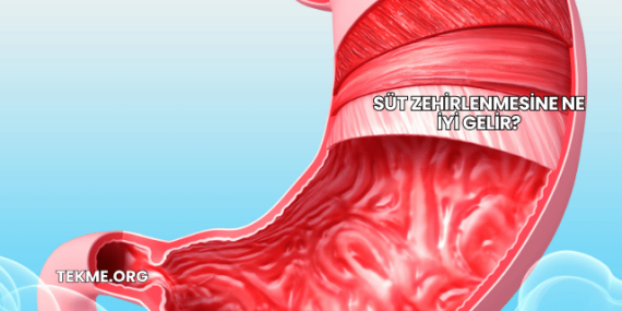 Süt Zehirlenmesine Ne İyi Gelir?