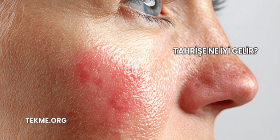 Tahrişe Ne İyi Gelir?