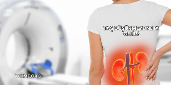 Taş Düşürmeye Ne İyi Gelir?