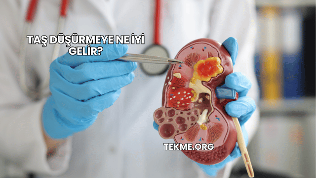Taş Düşürmeye Ne İyi Gelir?