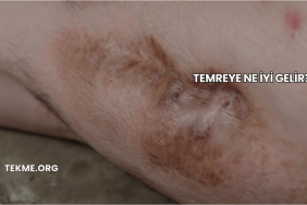 Temreye Ne İyi Gelir?