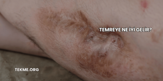 Temreye Ne İyi Gelir?