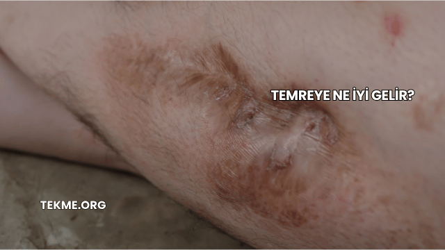 Temreye Ne İyi Gelir?