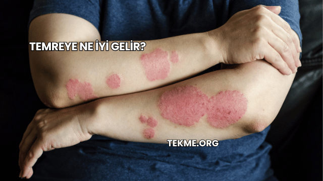 Temreye Ne İyi Gelir?