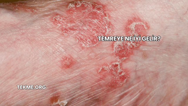Temreye Ne İyi Gelir?