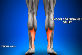 Tendon Ağrısına Ne İyi Gelir?