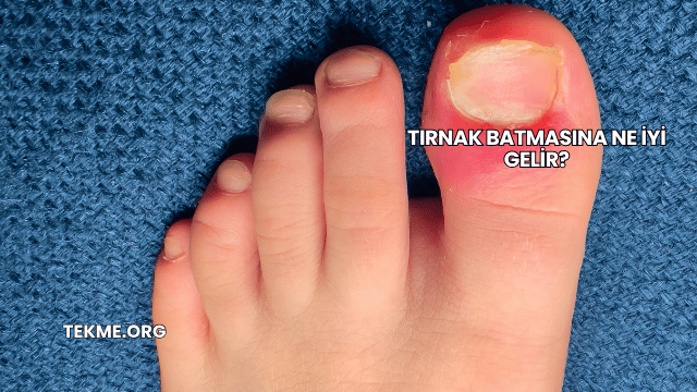 Tırnak Batmasına Ne İyi Gelir?