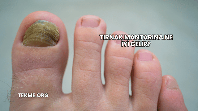 Tırnak Mantarına Ne İyi Gelir?