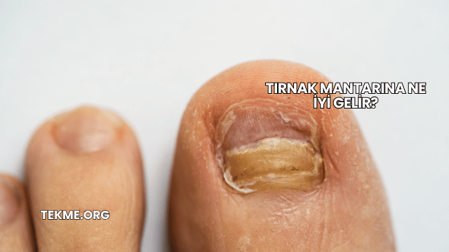 Tırnak Mantarına Ne İyi Gelir?