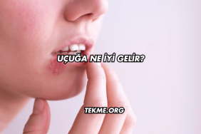 Uçuğa Ne İyi Gelir?