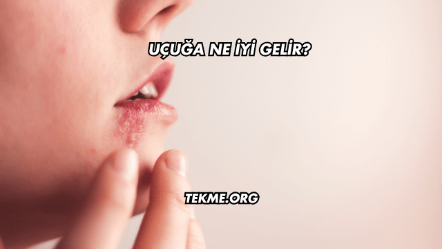Uçuğa Ne İyi Gelir?