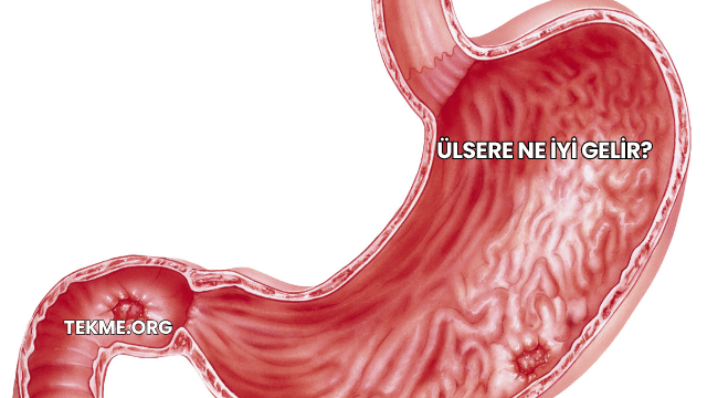 Ülsere Ne İyi Gelir?