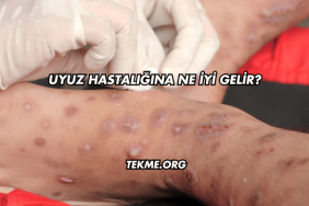 Uyuz Hastalığına Ne İyi Gelir?