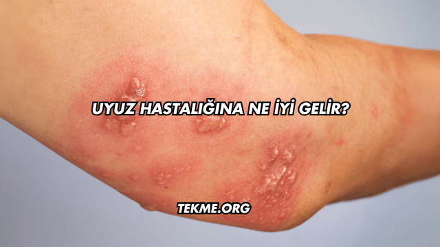 Uyuz Hastalığına Ne İyi Gelir?
