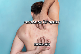 Uyuza Ne İyi Gelir?