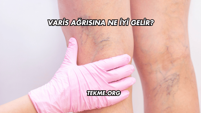 Varis Ağrısına Ne İyi Gelir?