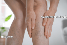 Varislere Ne İyi Gelir?