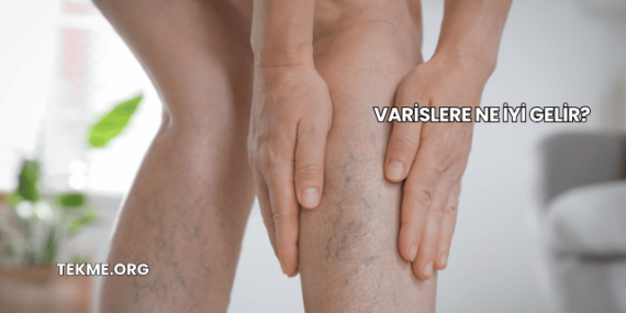 Varislere Ne İyi Gelir?