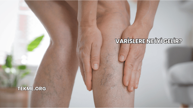 Varislere Ne İyi Gelir?