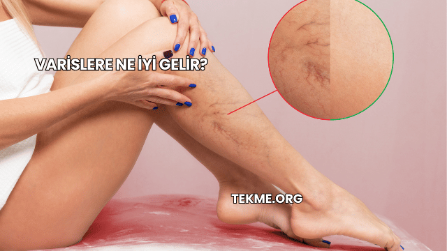 Varislere Ne İyi Gelir?