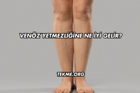 Venöz Yetmezliğine Ne İyi Gelir?