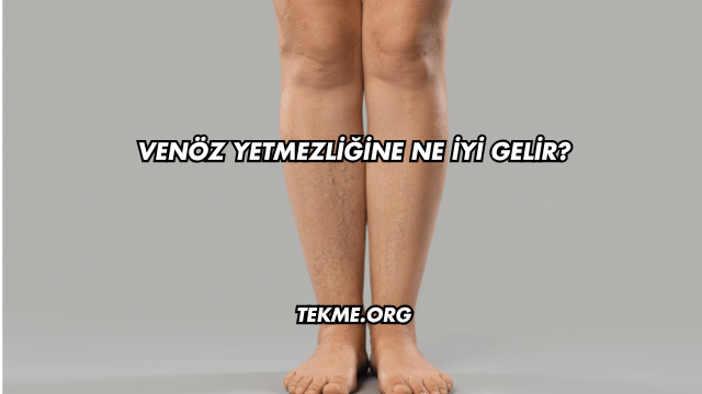 Venöz Yetmezliğine Ne İyi Gelir?