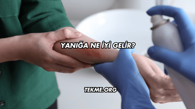 Yanığa Ne İyi Gelir?