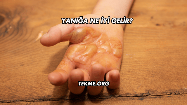 Yanığa Ne İyi Gelir?