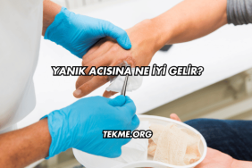 Yanık Acısına Ne İyi Gelir?
