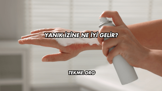 Yanık İzine Ne İyi Gelir?