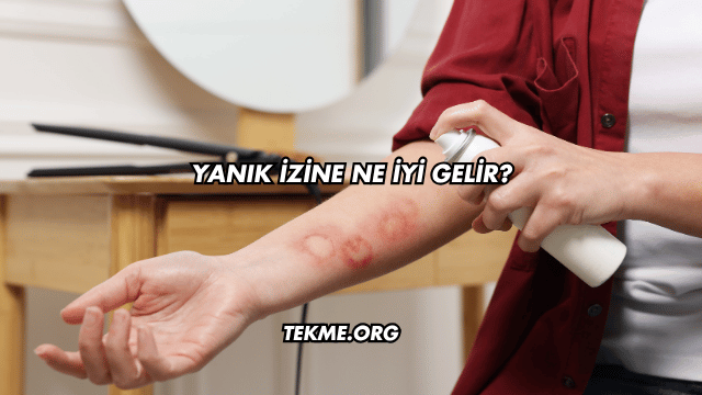 Yanık İzine Ne İyi Gelir?
