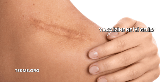 Yara İzine Ne İyi Gelir?