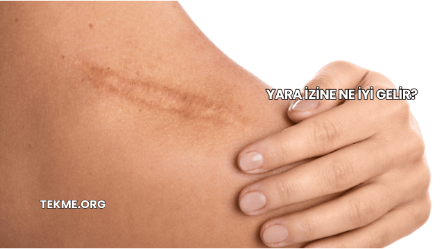 Yara İzine Ne İyi Gelir?