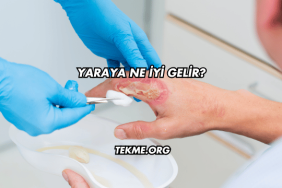 Yaraya Ne İyi Gelir?