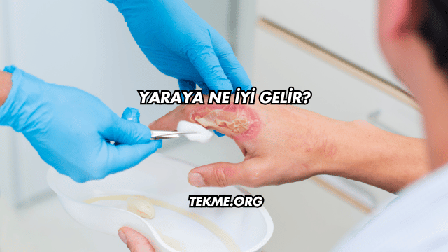 Yaraya Ne İyi Gelir?