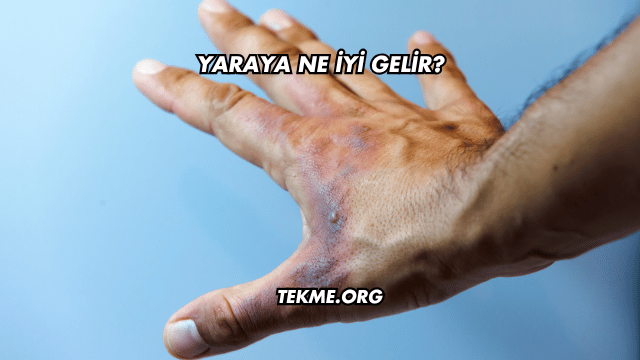 Yaraya Ne İyi Gelir?