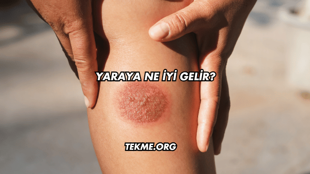 Yaraya Ne İyi Gelir?