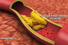 Yüksek Kolesterole Ne İyi Gelir?