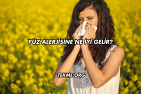 Yüz Alerjisine Ne İyi Gelir?