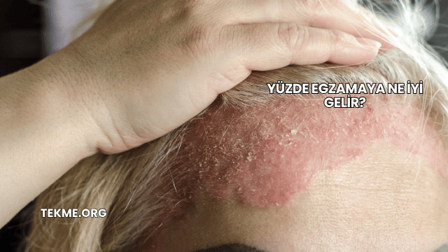 Yüzde Egzamaya Ne İyi Gelir?