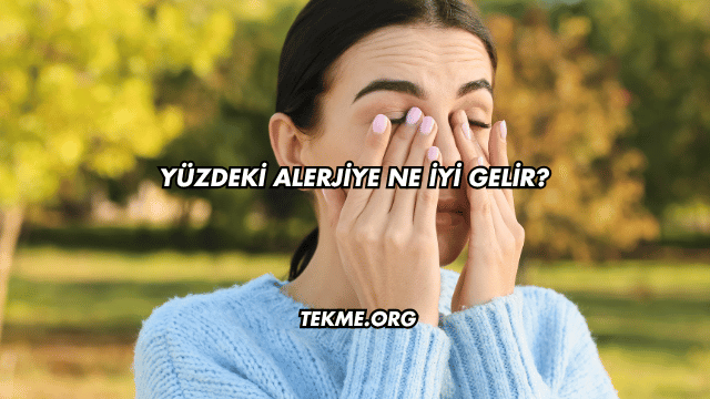 Yüzdeki Alerjiye Ne İyi Gelir?