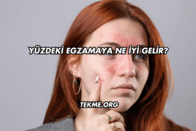 Yüzdeki Egzamaya Ne İyi Gelir?