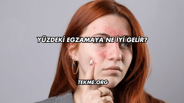 Yüzdeki Egzamaya Ne İyi Gelir?