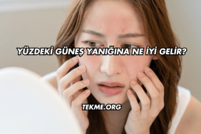 Yüzdeki Güneş Yanığına Ne İyi Gelir?