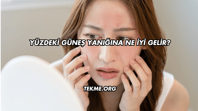 Yüzdeki Güneş Yanığına Ne İyi Gelir?