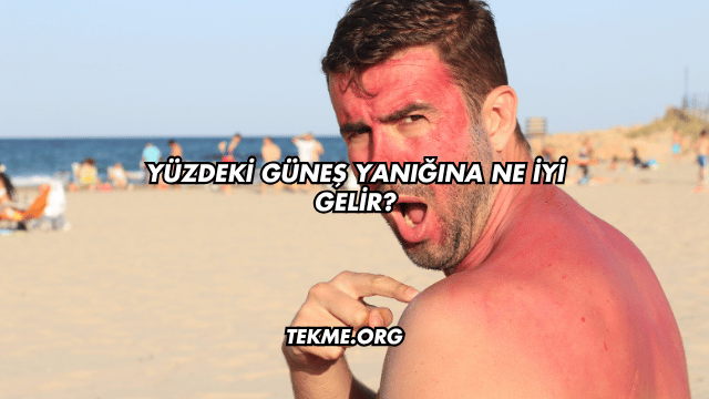 Yüzdeki Güneş Yanığına Ne İyi Gelir?