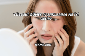 Yüzdeki Güneş Yanıklarına Ne İyi Gelir?
