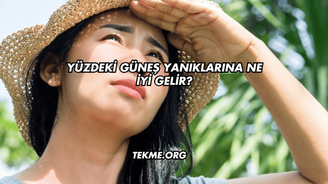 Yüzdeki Güneş Yanıklarına Ne İyi Gelir?