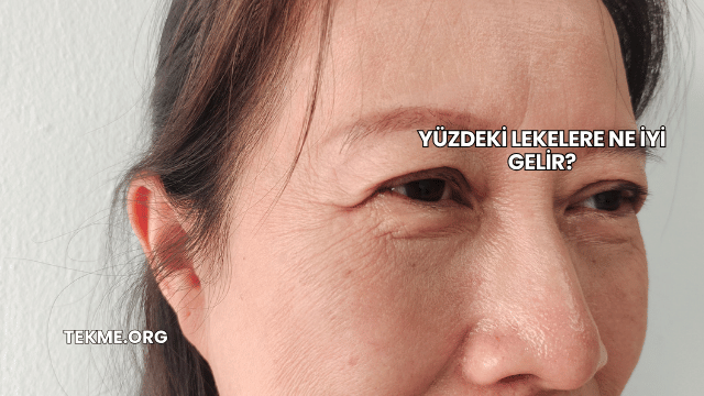 Yüzdeki Lekelere Ne İyi Gelir?
