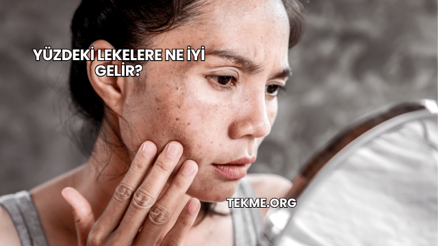 Yüzdeki Lekelere Ne İyi Gelir?